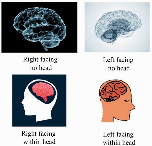 Turning the Other Lobe: Directional Biases in Brain Diagrams