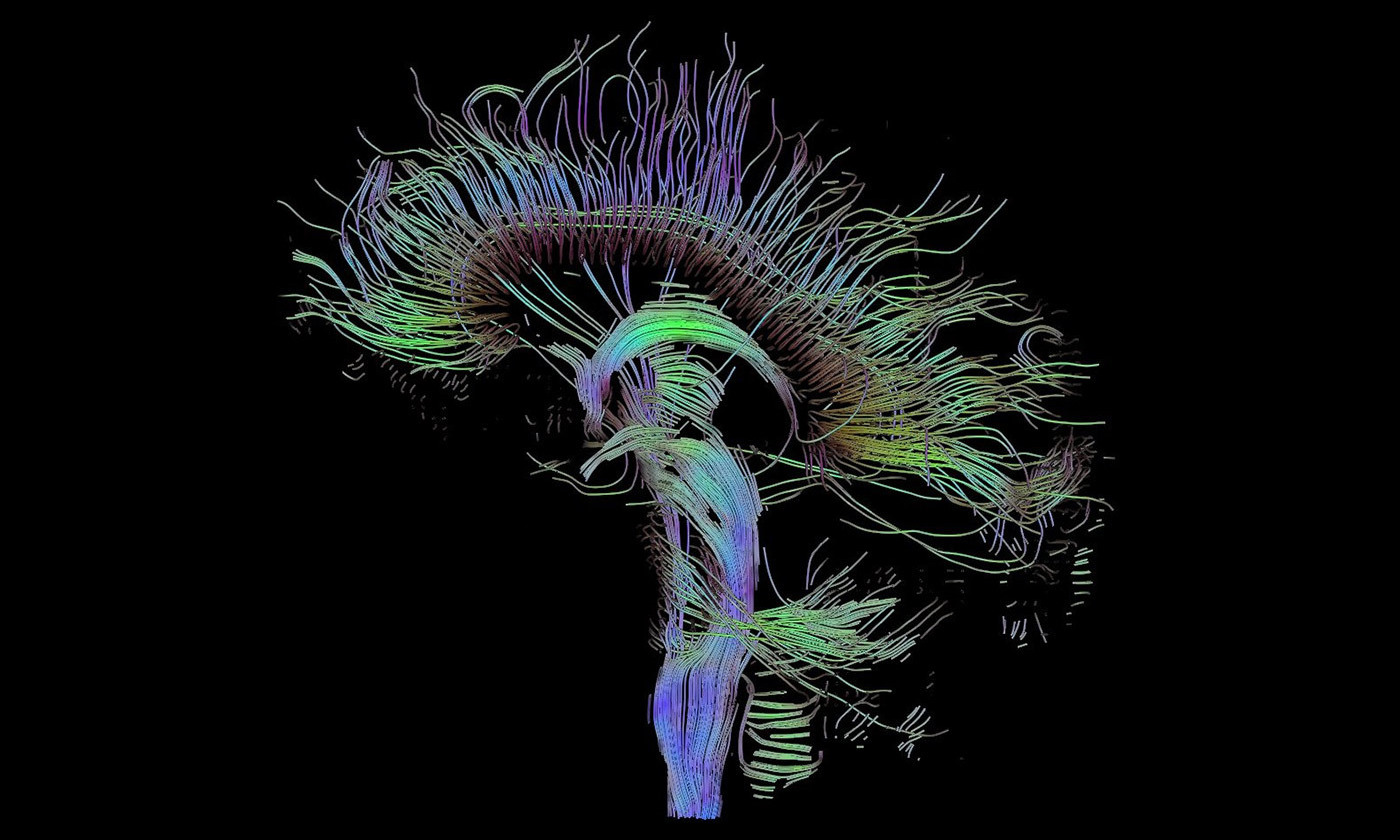 How Brain Stimulation Can Boost Memory If Paired With Learning