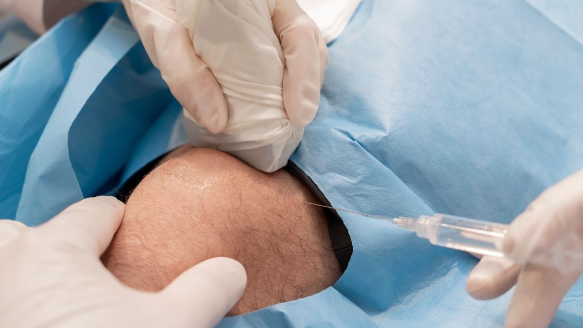 Stem cell injection being administered to a knee joint as part of non-surgical treatment for chronic joint pain